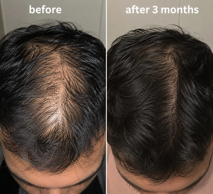 Tresora Aura Root Strength Hair Oil