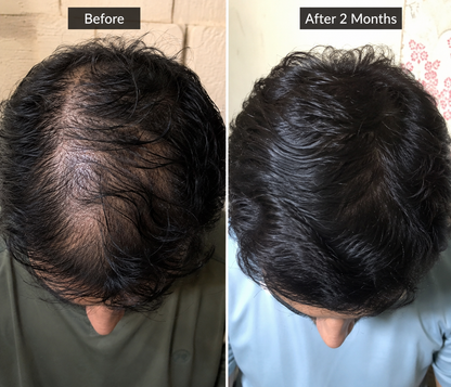 Tresora Aura Root Strength Hair Oil