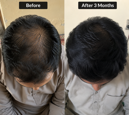 Tresora Aura Root Strength Hair Oil