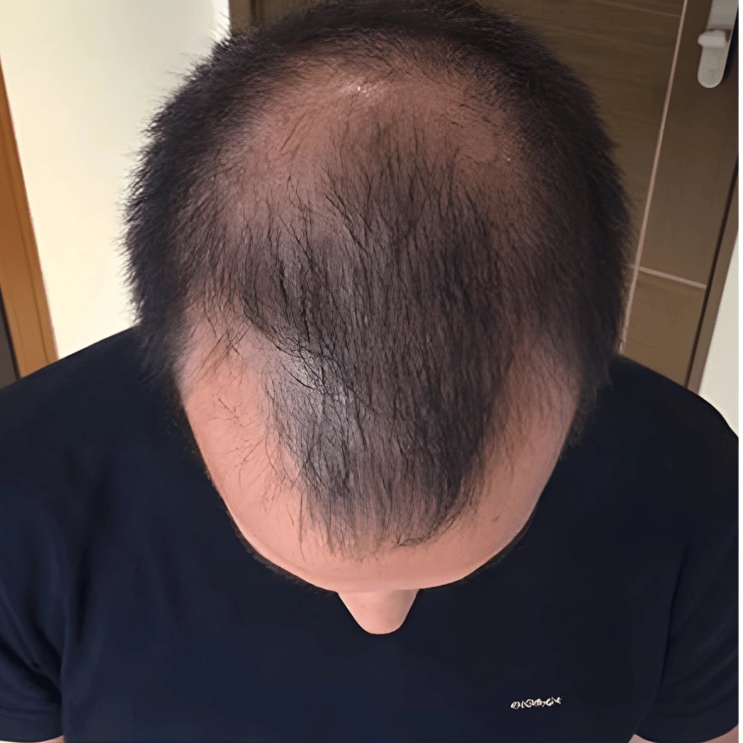 Before