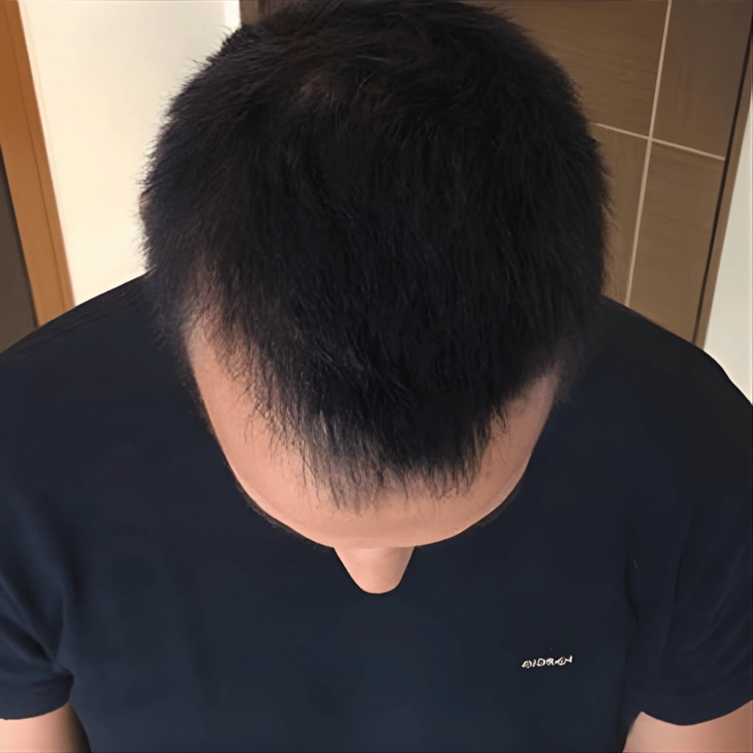 After